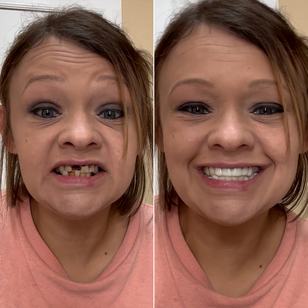 Revealing my smile secret