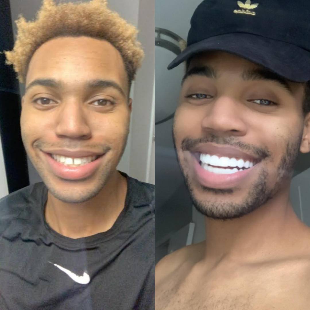 I'm made to smile