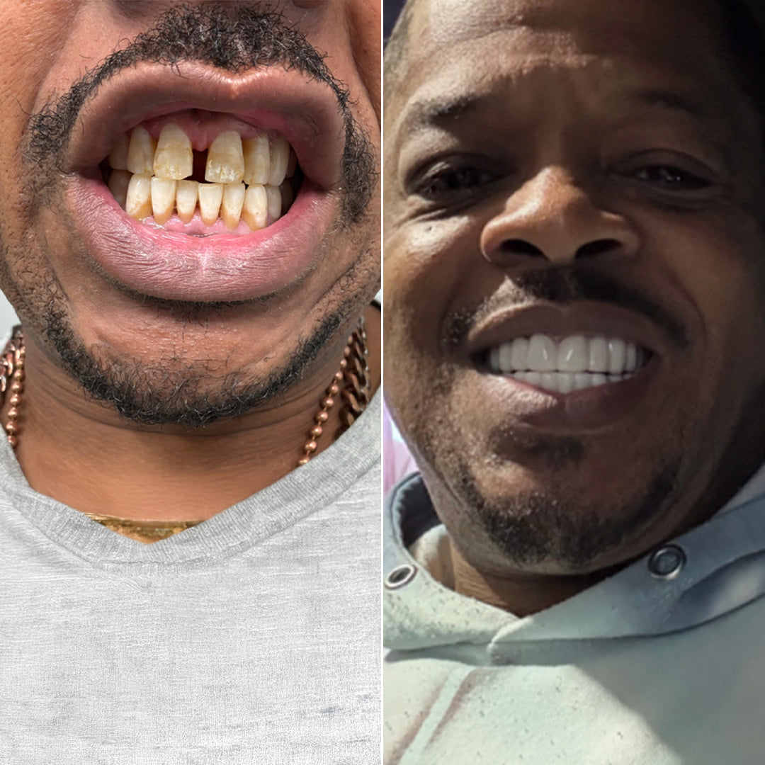 Got a Hollywood smile!