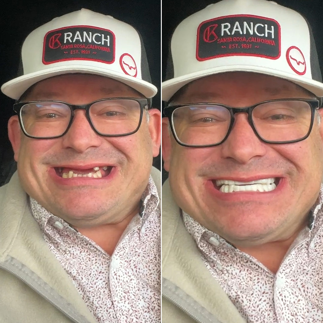 Huge enhancement to my smile!
