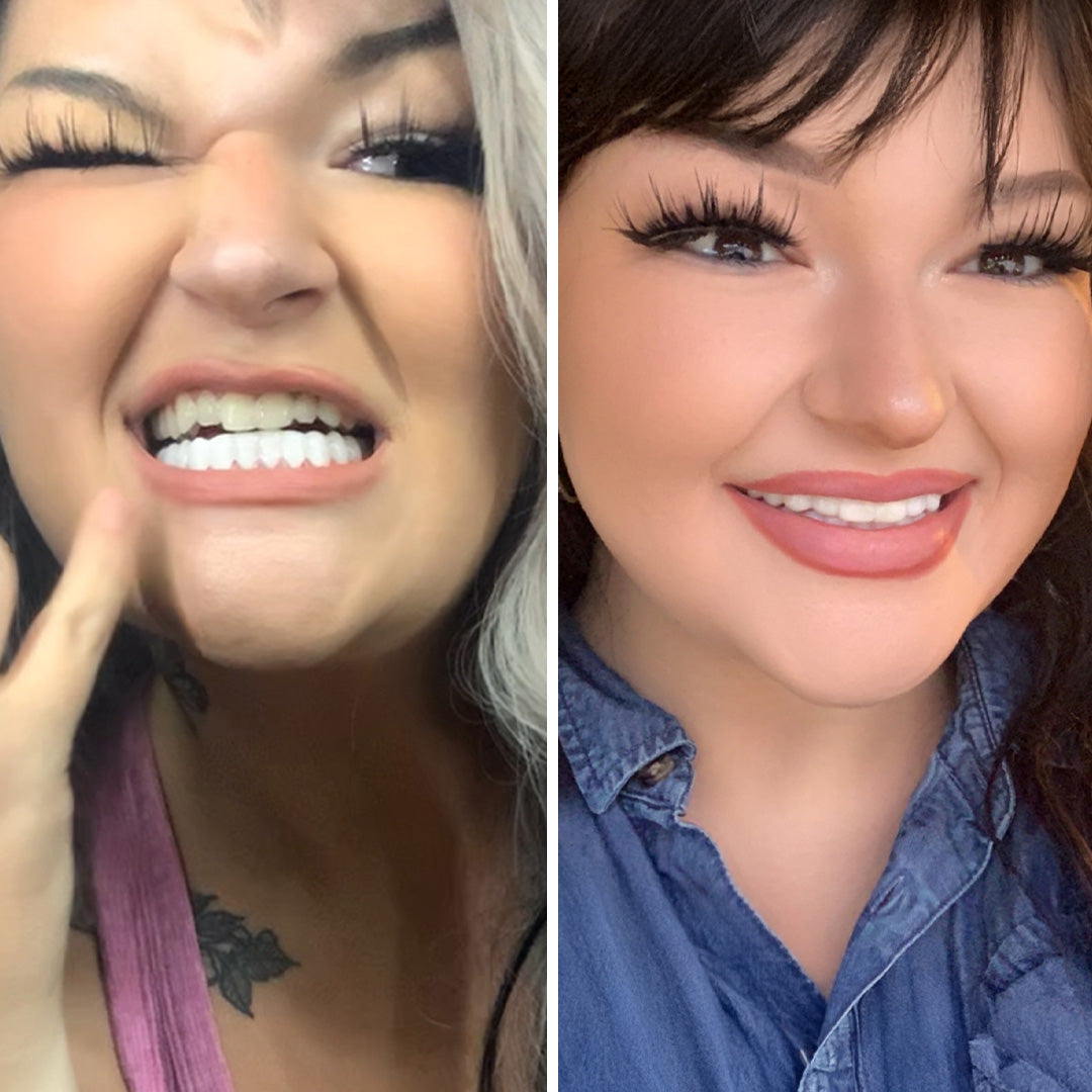 5 star smile