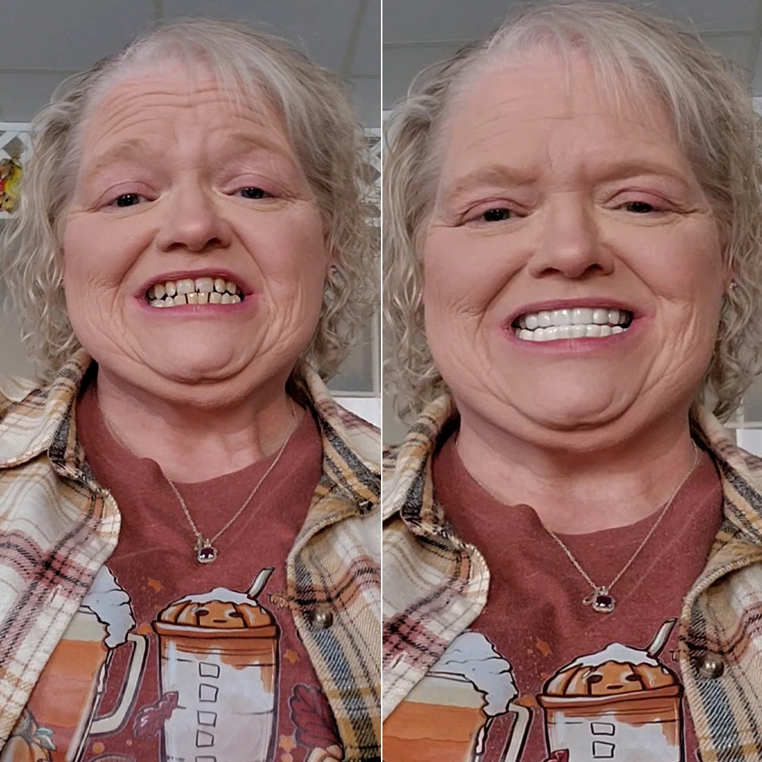 Confident new smile with Pop On!