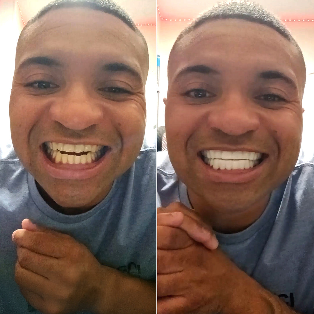 Night and day difference