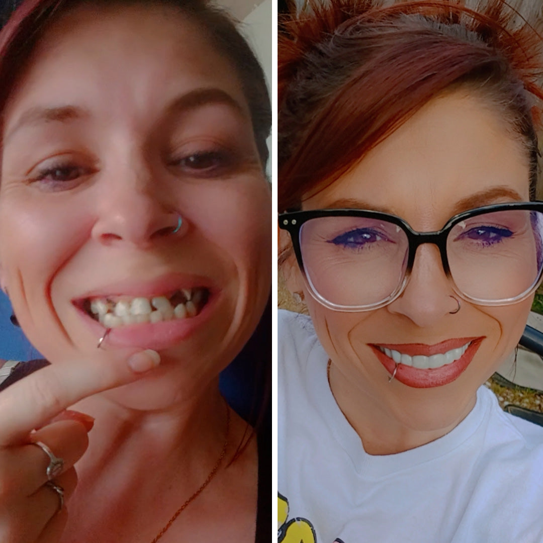 I have not seen my smile in years