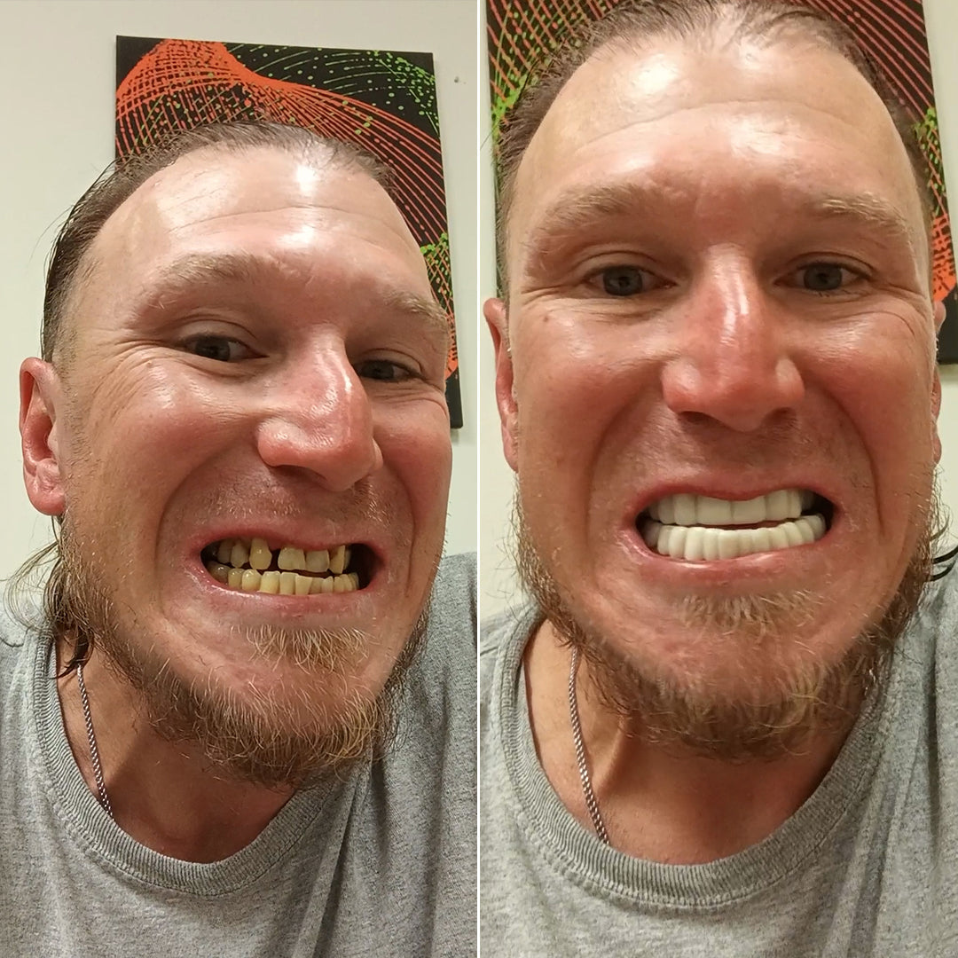 Ready to smile again?