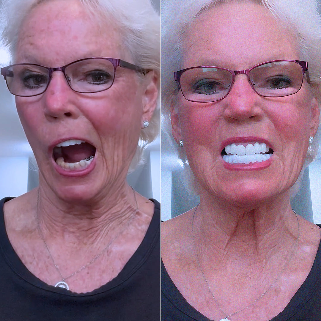 A new smile without breaking the bank!