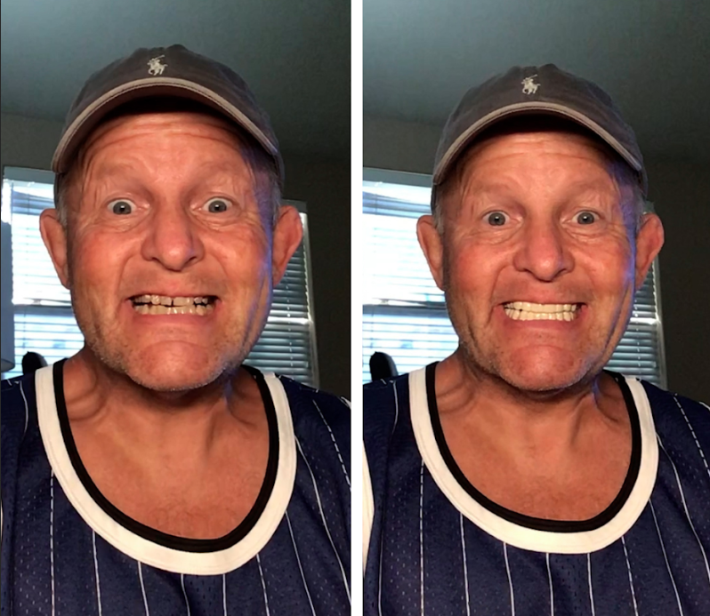 Now I smile more!