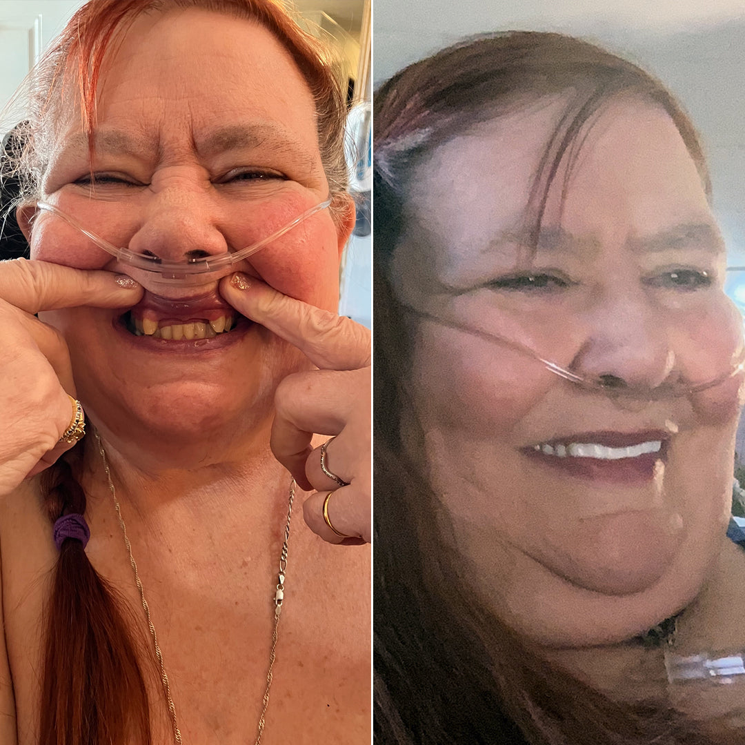 I can smile to the world now!