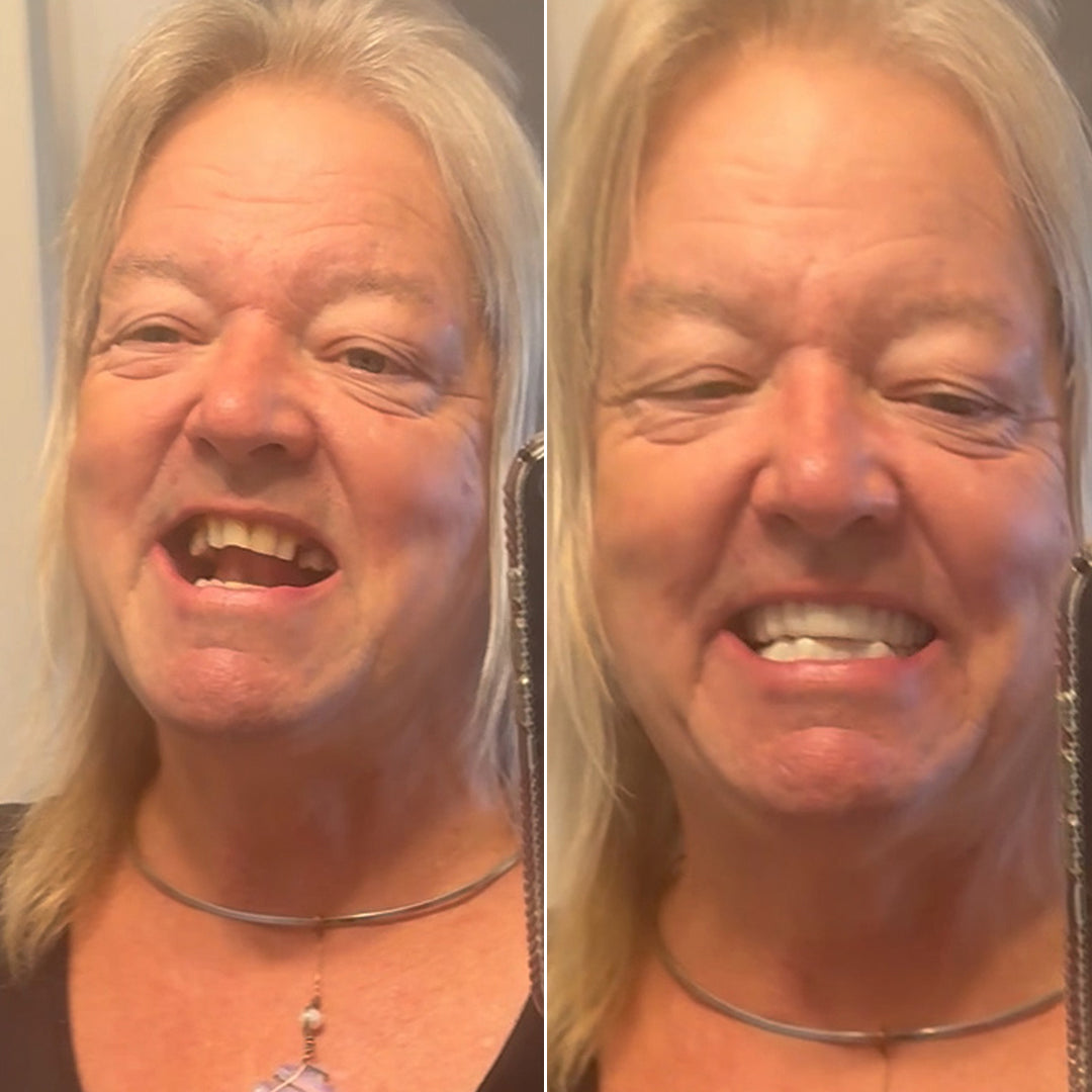 Don’t let your smile hold you back