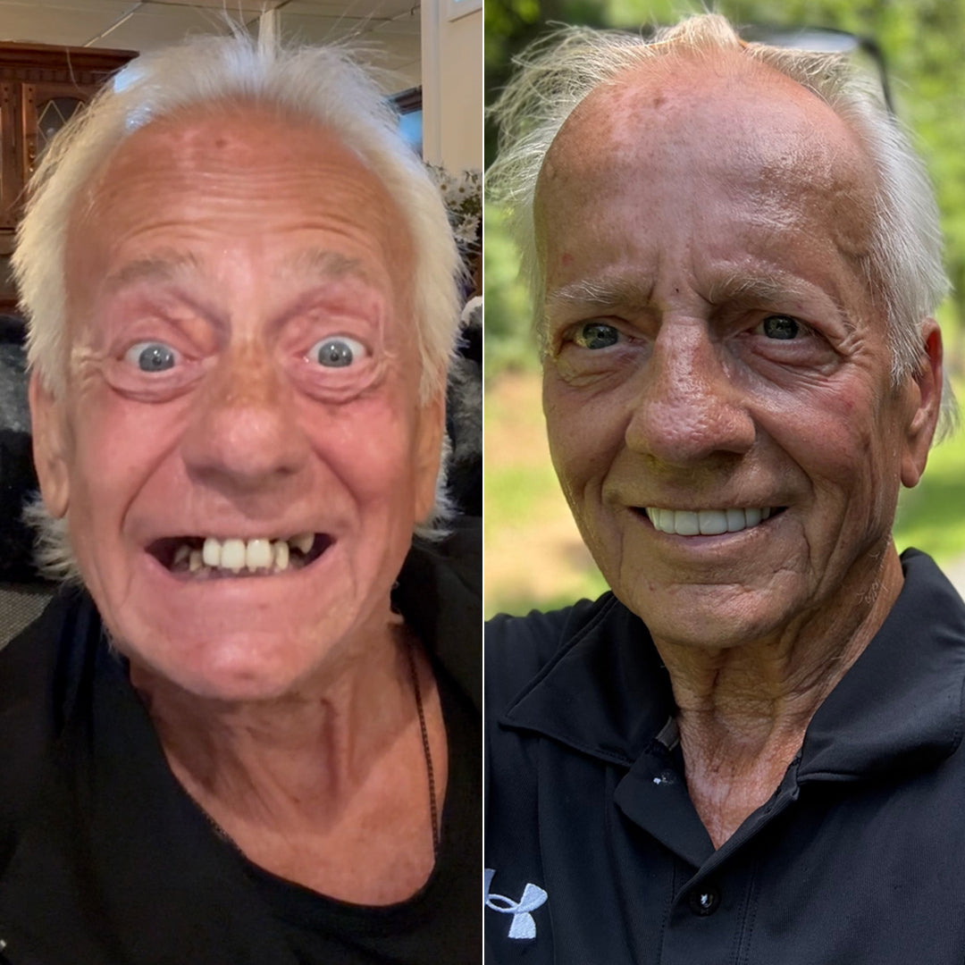 This smile transformation is amazing!