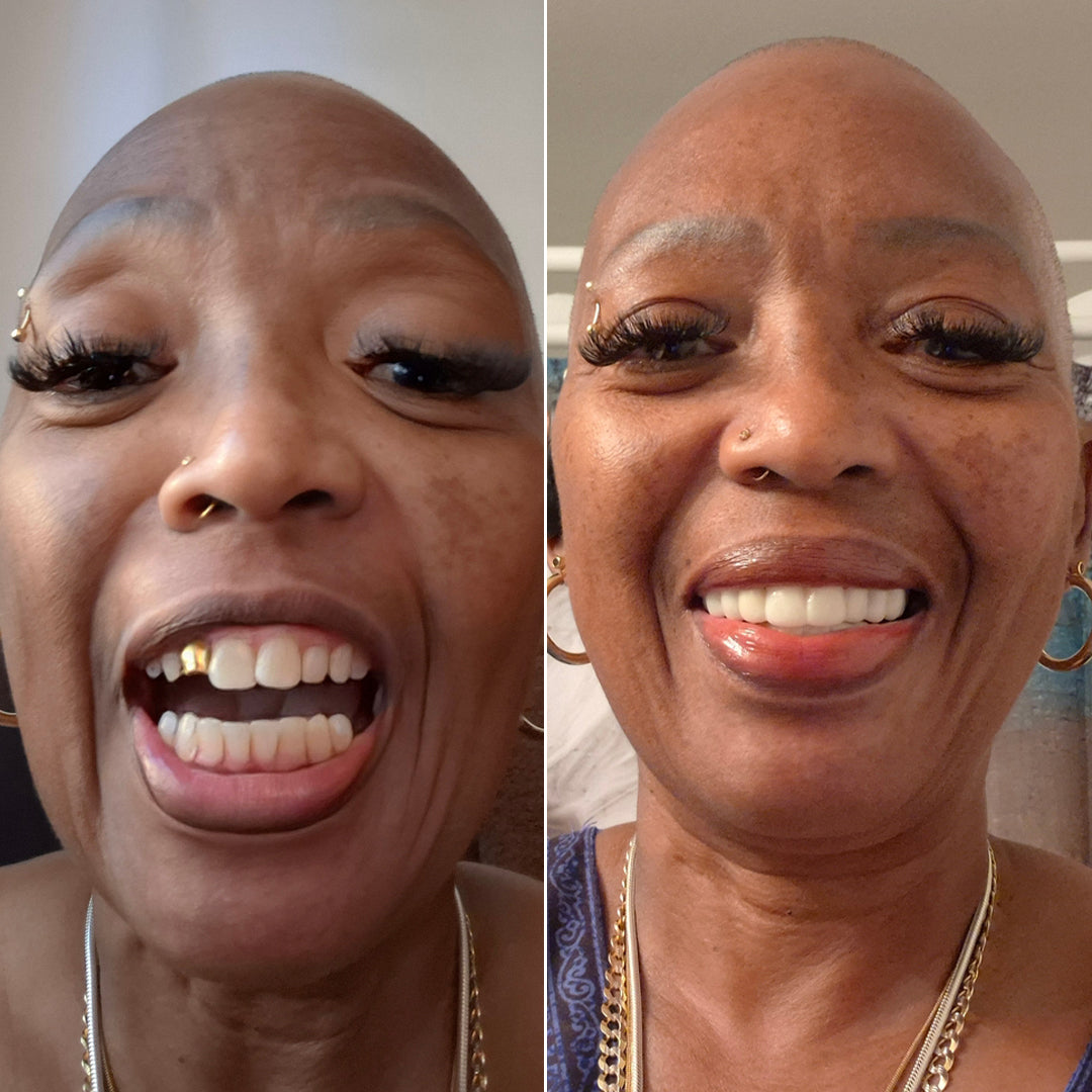 Your smile deserves the real deal