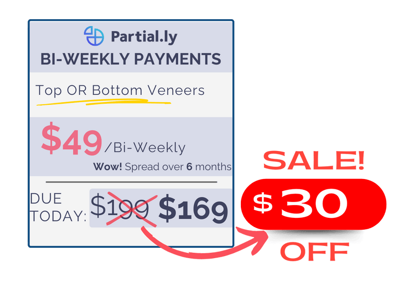 Bi-Weekly Payment Plan - Pop On Veneers with At Home Impression Kit - $30 Off