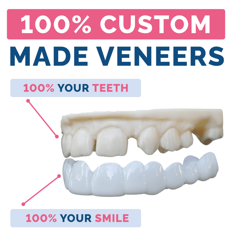 Payment Plan - Pop On Veneers - With At Home Impression Kit