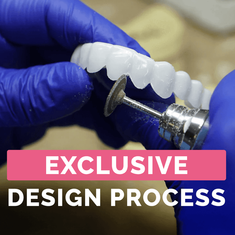 Payment Plan - Pop On Veneers - With At Home Impression Kit