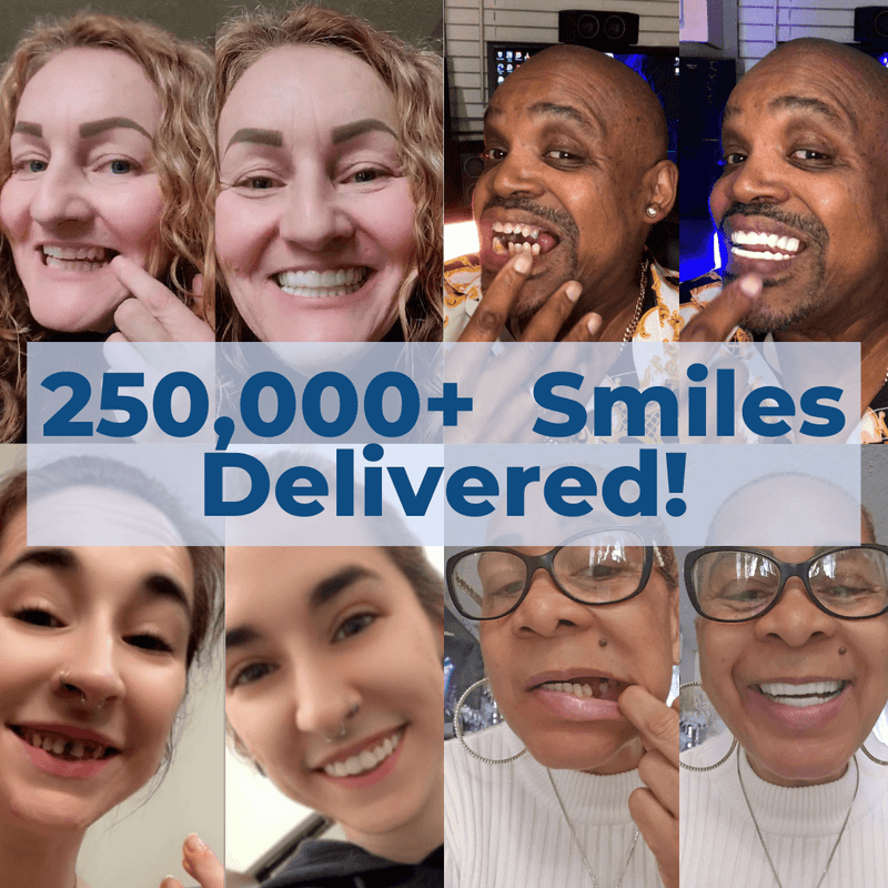 Payment Plan - Pop On Veneers - With At Home Impression Kit