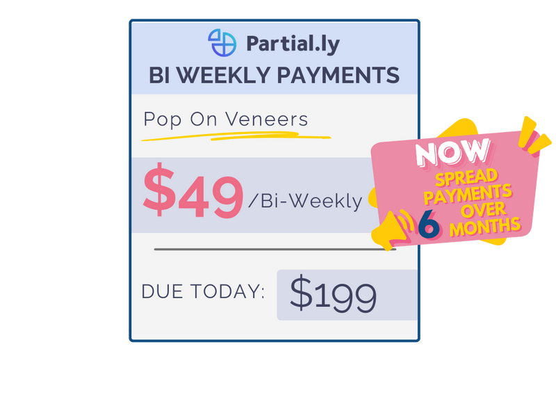 Bi-Weekly Payment Plan - Pop On Veneers with At Home Impression Kit
