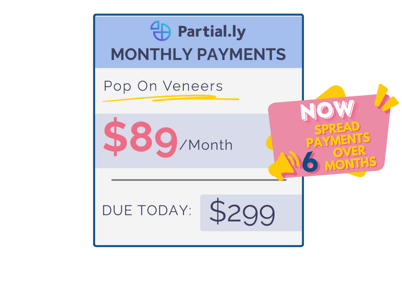 Monthly Payment Plan - Pop On Veneers with At Home Impression Kit