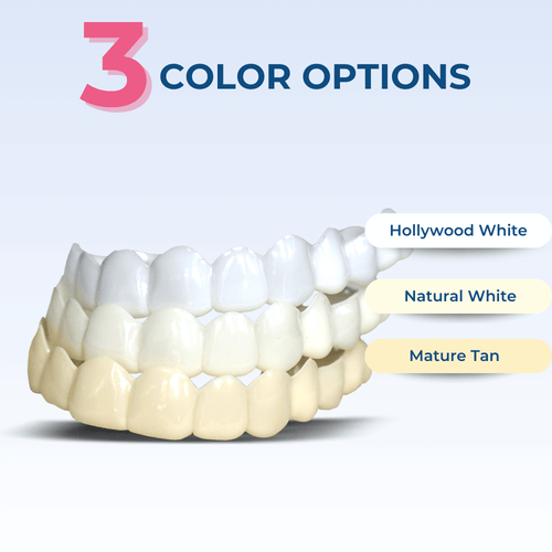 Add Opposite Arch After Veneers Delivered