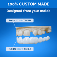 Pop On Veneers with Impression Kit