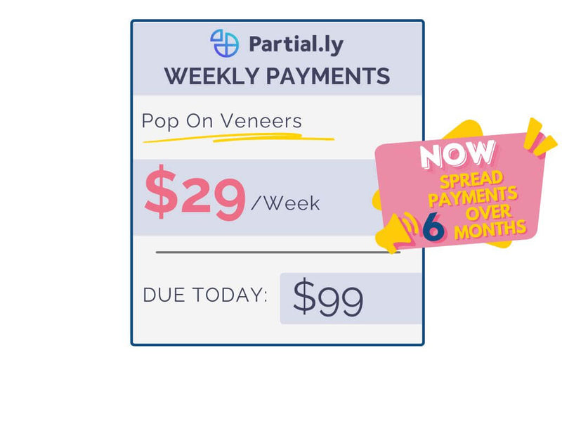 Weekly Payment Plan - Pop On Veneers with At Home Impression Kit