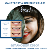 Reward 1 | Spare Veneer | Single Arch ($189 Value)